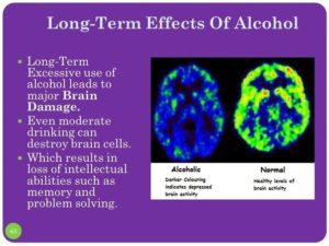 Treating Alcoholism with Cannabis | Blog Philosopher Seeds